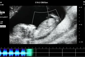 抖音快手无人直播胎教助眠全攻略：教程+软件+素材